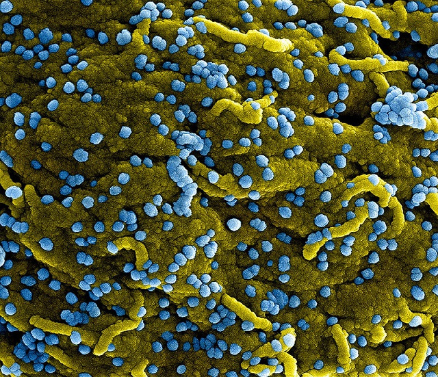 Surveillance du coronavirus: des seychellois étudiant à Wuhan, en Chine, arrivent en bonne santé en France