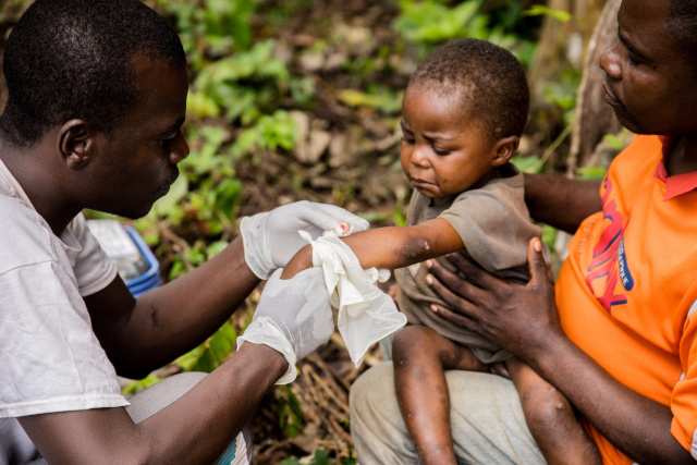 Rare monkeypox outbreaks detected in N.America, Europe